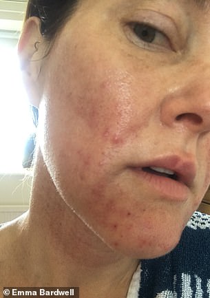 Emma Bardwell alipunguza uzito na kuimarika kwa chakula rahisi